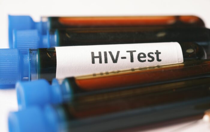 HIV / AIDS Test